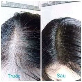 Dầu xả Vijully hoa cúc