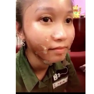 Peel Tca dành cho mặt cam kết hiệu quả chất lượng