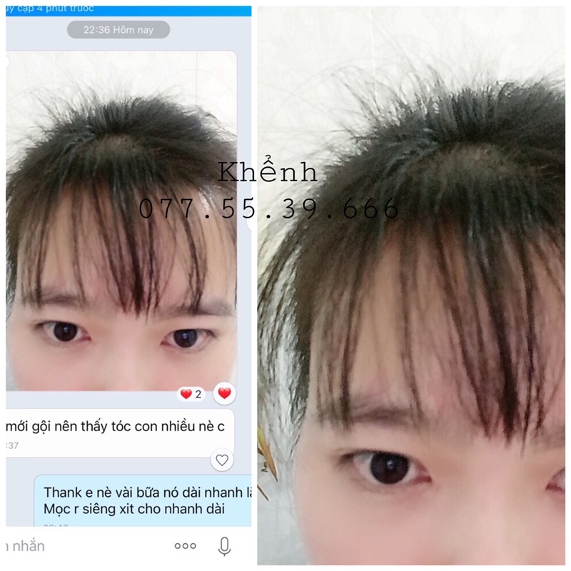 Dầu Ủ Oil Treatment Mọc Tóc Nhanh Dày Dài