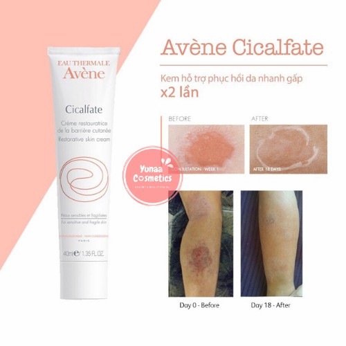 Kem dưỡng liền sẹo Avene Cicalfate+ Repairing Protective Cream/ Kem tái tạo hồi phục da Avene Cicalfate Repair Cream
