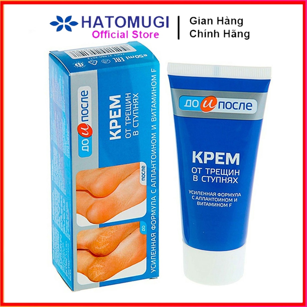 Kem Giảm nứt gót chân Kpem Apteka Chính Hãng 50ml Nga