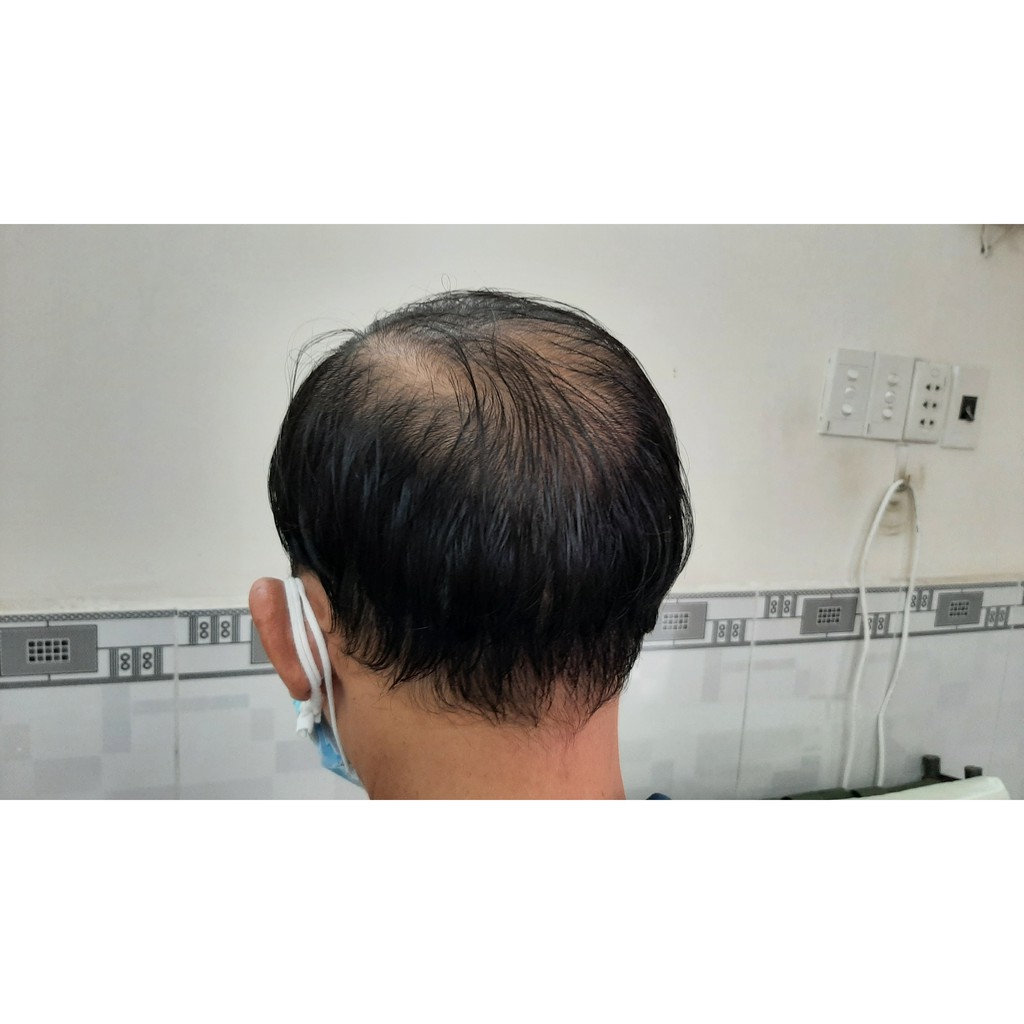 Tóc Giả Ngắn Dành Cho Nam - Chất lượng số 1
