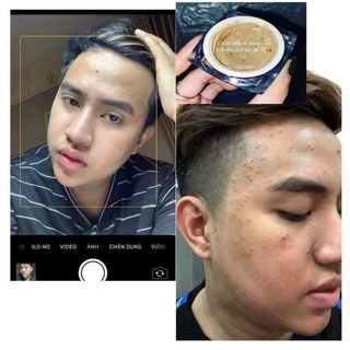 Cao Mụn Sâm Đỏ 36 Vị
