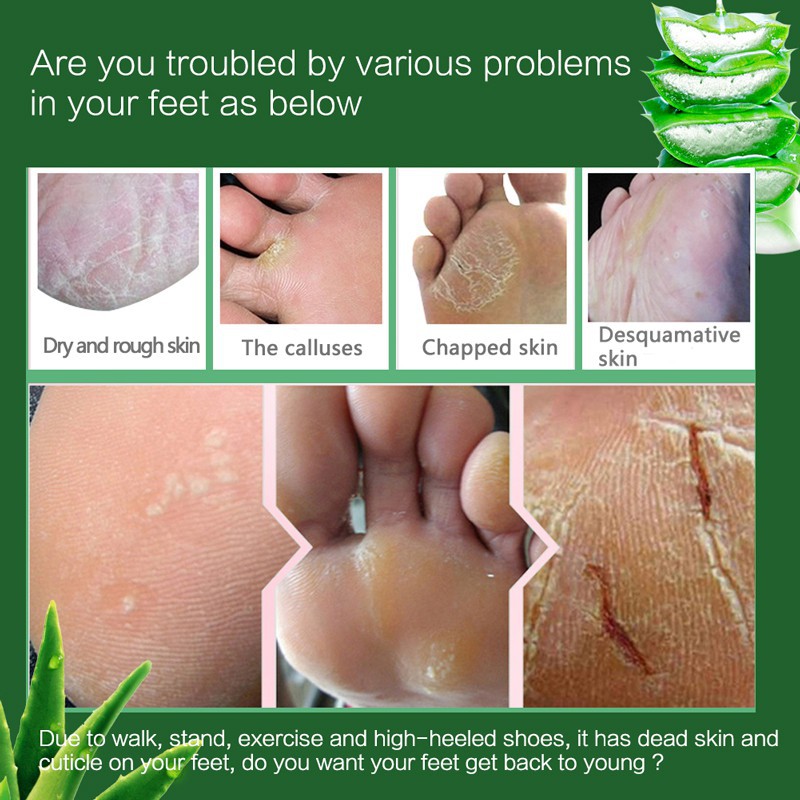 Mặt nạ dưỡng da chân dạng lột thành phần lô hội giúp tẩy tế bào da chết chống nứt nẻ | BigBuy360 - bigbuy360.vn