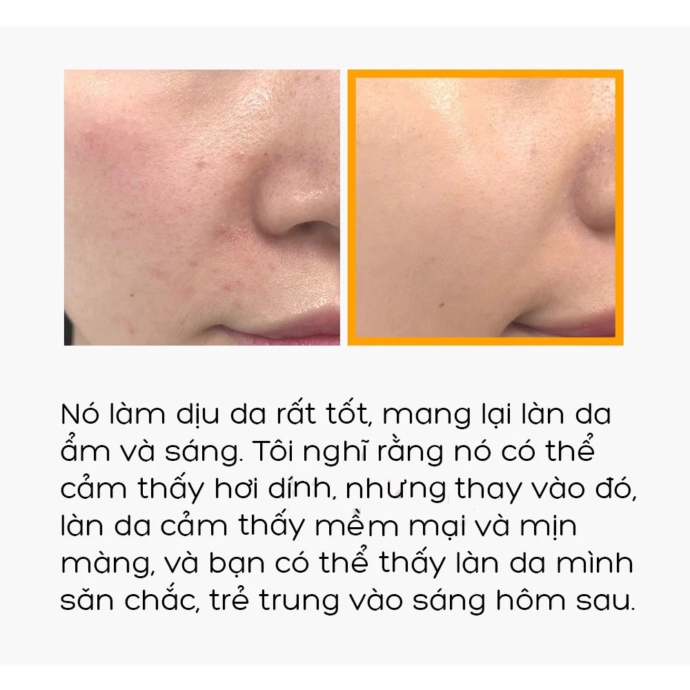 Tinh Chất Làm Dịu Da Chiết Xuất Mật Ong SOMEBYMI Propolis B5 Glow Barrier Calming Serum 50ml