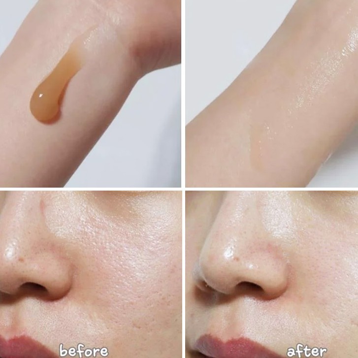 Kem Dưỡng Skin1004 Madagascar Centella Dưỡng Ẩm Phục Hồi Da Chuyên Sâu &quot; OAM &quot;