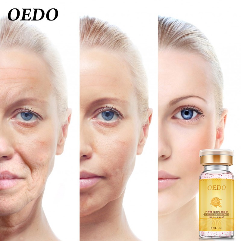 OEDO Facial Care Set：Facial Cleanser + Serum + Aloe Vera Gel + Cream