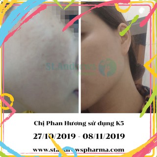 hien04 [HÀNG NHẬP KHẨU CHÍNH HÃNG ITALIA] Kem Xóa Nám Mảng, Nám Chân Sâu, Nám Sau Sinh K5 LIPOGEL - B.sy Khuyên Dùng