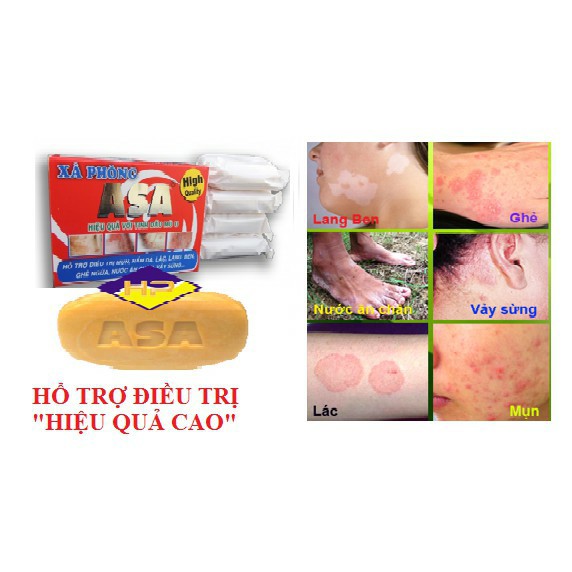 Xà phòng ASA  hỗ trợ diệt khuẩn gây mụn, nấm, lác và các bệnh ngoài da 120gr ( Hộp x 4 Cục)