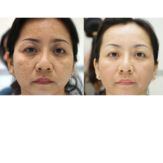 Kem sâm Cream Smartcos Skginseng dưỡng da trắng sáng Học viện quân y Việt nam (30g) | BigBuy360 - bigbuy360.vn