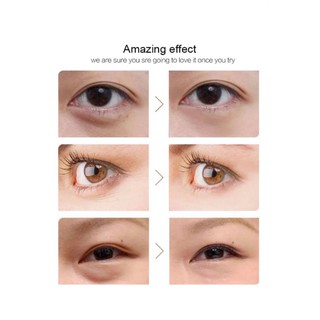 [HÀNG CHÍNH HÃNG] MIẾNG DÁN MẮT DARKNESS COLLAGEN HYDROGEL PATCH