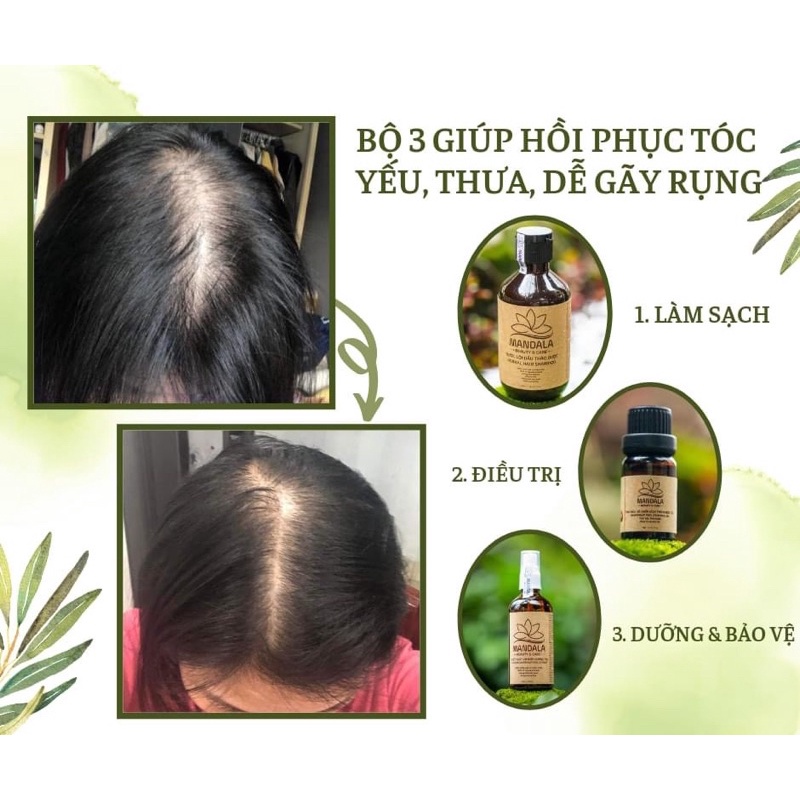 Dầu gội Mandala, nước gội Mandala, dầu gội bưởi kích mọc tóc