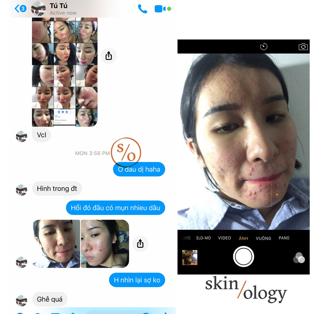 GIẢI PHÁP NGỪA MỤN NÁM SẸO RỖ TÁI TẠO LÀN DA MỚI SKIN RENEWAL SOLUTION BẰNG THẢO DƯỢC DÀNH CHO MỌI LOẠI DA | BigBuy360 - bigbuy360.vn