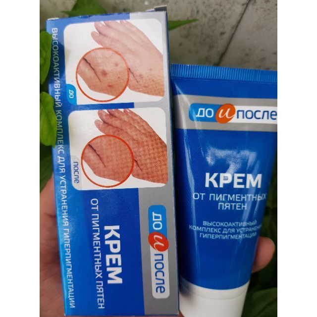 Kem loại bỏ đồi môi kpem nga_kem loại bỏ đồi môi tay chân