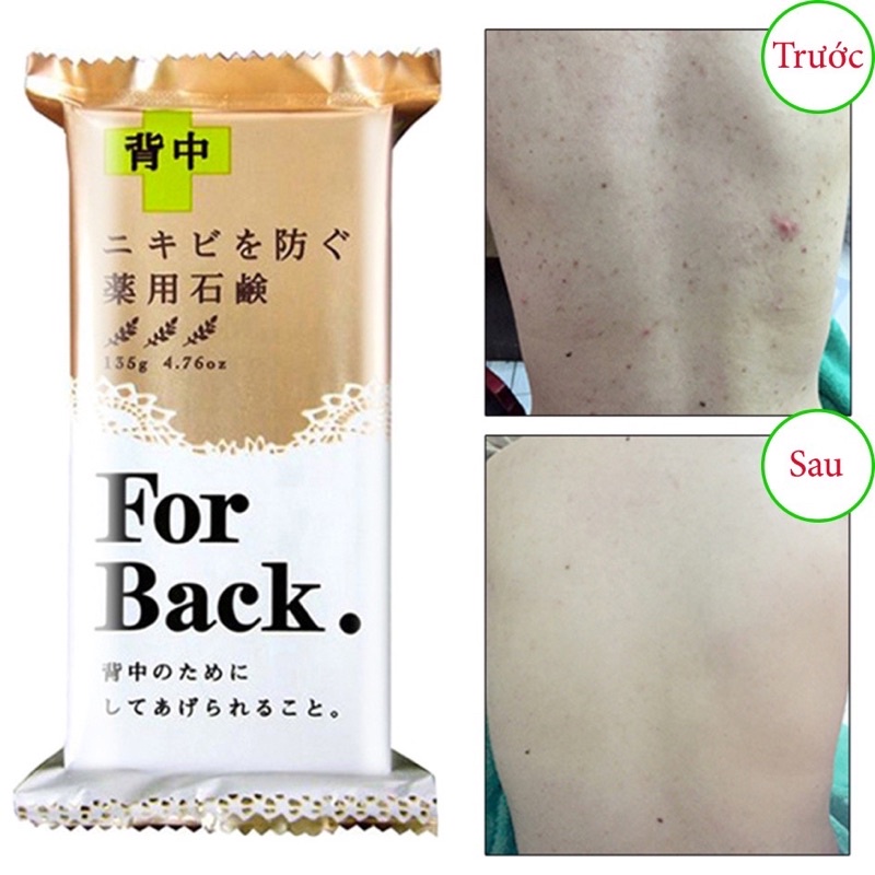 Xà Phòng Ngừa Mụn Lưng For Back Nhật Bản | BigBuy360 - bigbuy360.vn