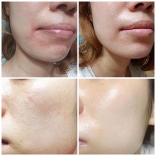 Toner cấp nước phục hồi da mỏng yếu Civasan Noraxis 2nd Scene 300ml