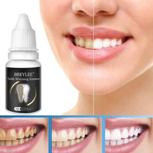 Tinh Chất Làm Trắng Răng Teeth Whitening Essence Breylee EN