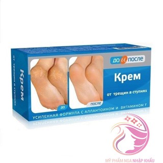 Kem dưỡng ngăn ngừa nứt gót chân Kpem Cream for Carcks in the feet 50ml