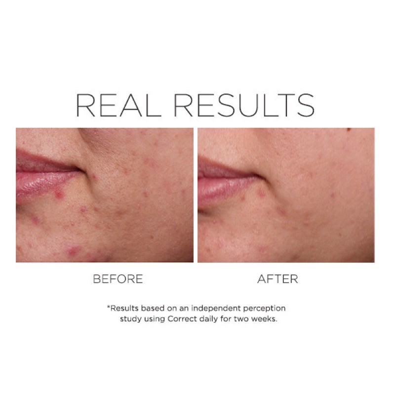 Serum phục hồi tái tạo da Cosmedix C.P.R Skin Recovery Serum