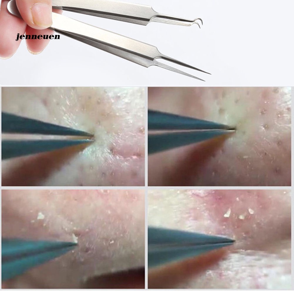 Nhíp nặn mụn đầu đen có mũi cong tiện lợi