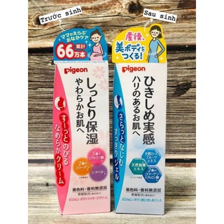 Kem bôi rạn da cho bà bầu Pigeon Nhật Bản