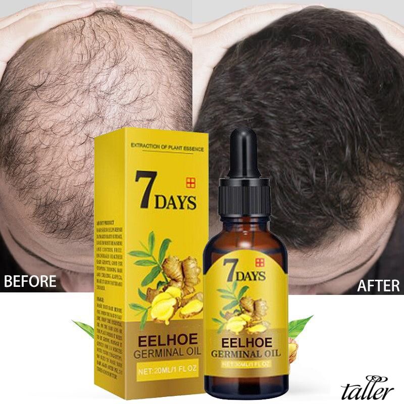 Tóc Tăng Trưởng Sản Phẩm Gừng Nhanh Tăng Trưởng Tóc Vẻ Đẹp Tinh Dầu Chăm Sóc Tóc Ngăn Ngừa Rụng Tóc Dầu Da Đầu Điều Trị Cho Nam Giới phụ nữ