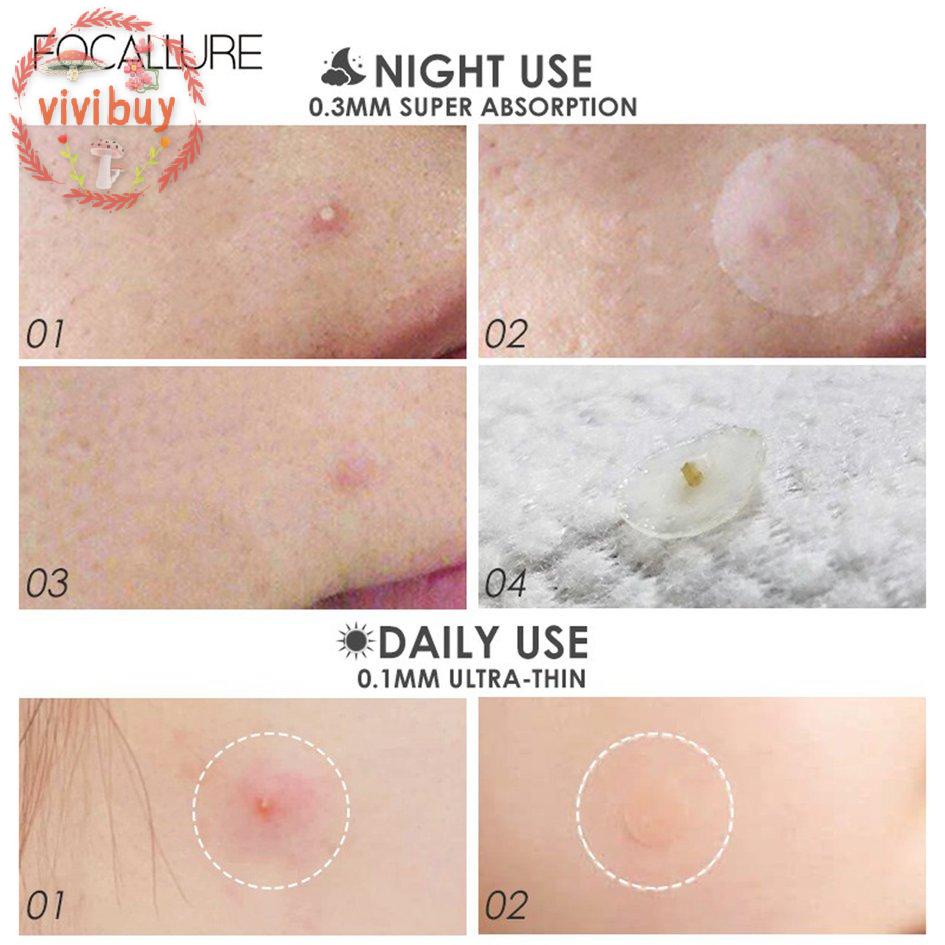 Miếng dán hydrocolloid trong suốt che khuyết điểm chống nước
 | BigBuy360 - bigbuy360.vn