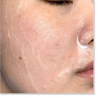 Sữa Rửa Mặt Dạng Gel Eucerin Acne-Oil Control Pro Acne Solution Cleansing Gel