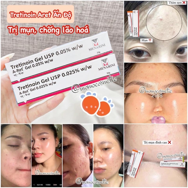 Tre Ấn Độ - Momo Cosmetic