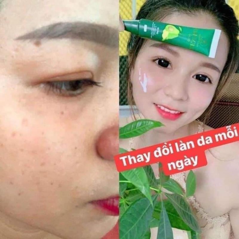 [ GIÁ GỐC ] KEM BƠ CẤY TRẮNG NANO OLIC DƯỠNG TRẮNG DA
