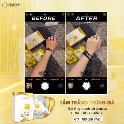 [Chính Hãng + Tặng Quà] Tắm Trắng Trứng Queenie Skin - Tắm Trắng Trứng Gà Queenie Skin