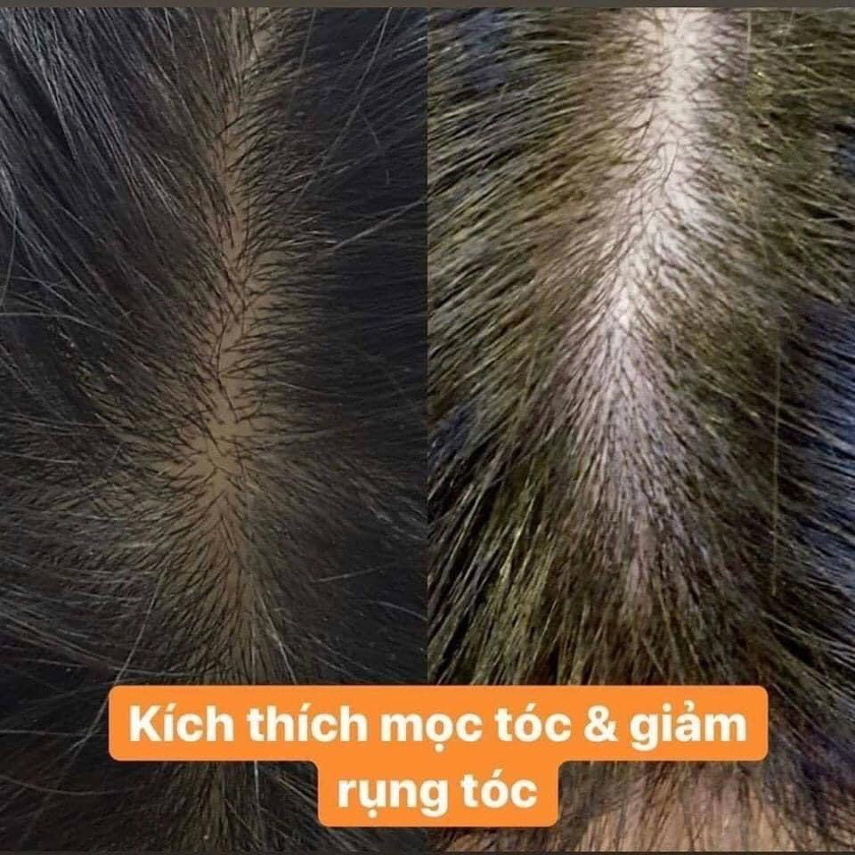 Dầu gội Klorane Quinquina hỗ trợ giảm rụng tóc - hỗ trợ mọc tóc chuẩn nội địa Pháp - Tami Store