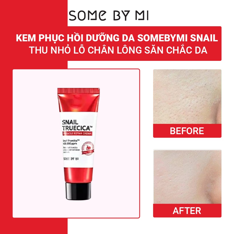 [Mã BMTTC60K giảm đến 60K đơn 50K] Bộ Dưỡng Phục Hồi Some By Mi Snail Truecica Miracle Repair Starter Kit Edition