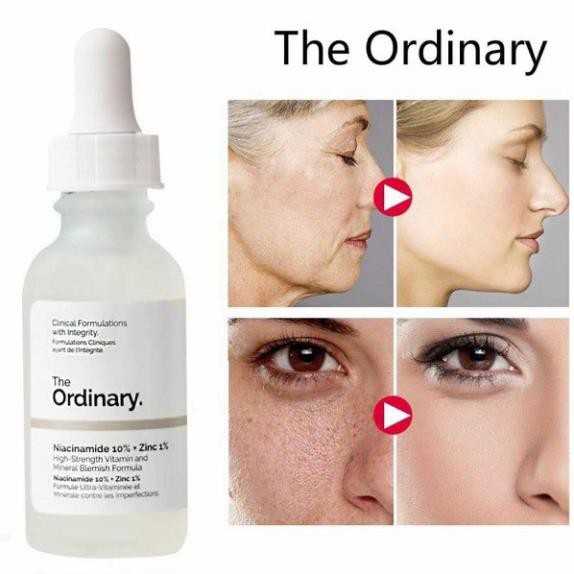 [Chính hãng] Serum sáng da, se khít lỗ chân lông The Ordinary Niacinamide 10% + Zinc 1%