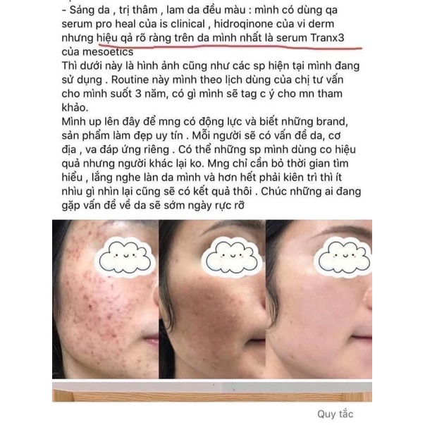 Gel Dưỡng Sáng Da, Giảm Nám Melan Tran3x Mesoestetic