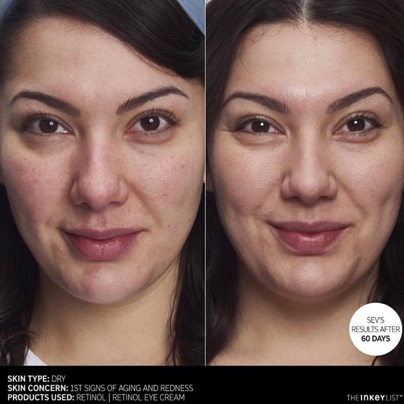 Tinh chất The Inkey List Retinol Serum 30ml