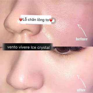 Siêu Serum Vento Ice - serum lạnh