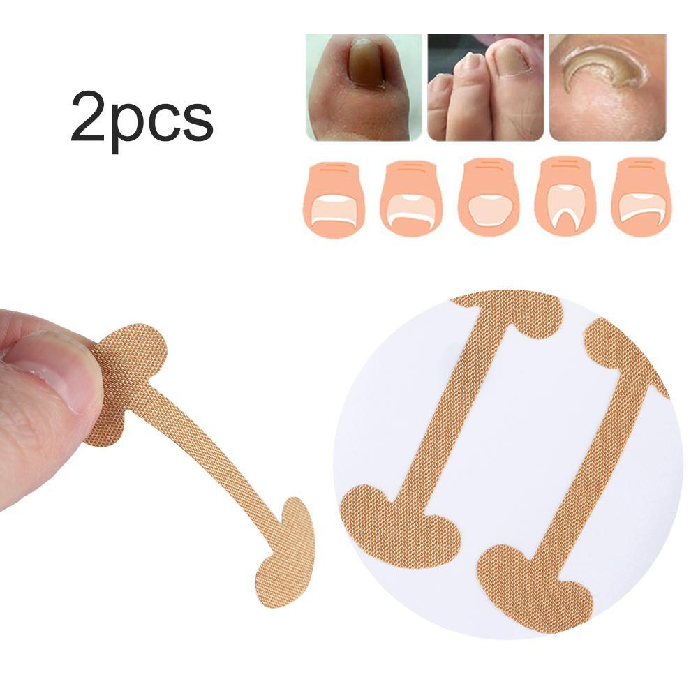 Miếng Dán Chỉnh Hình Móng Chân Chuyên Nghiệp