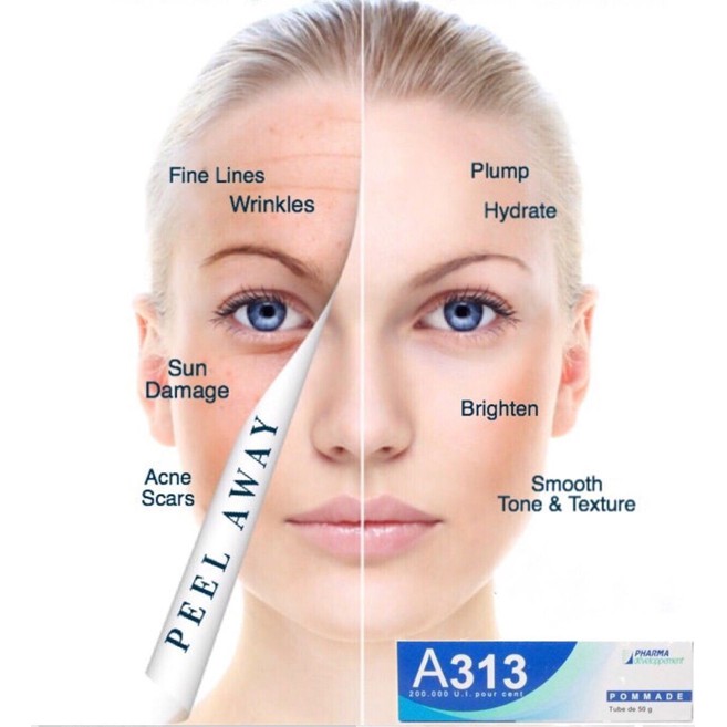 [A313 Retinol] Kem A313 Retinol giảm mụn,mờ thâm nám, sáng da 50g