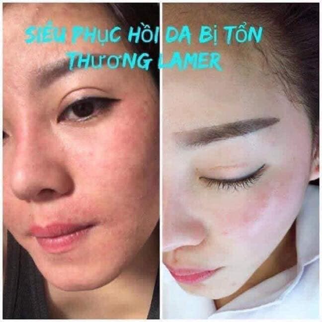 [CHÍNH HÃNG] Kem siêu phục hồi Lamer Dr Lacir - Cellule De Lacir