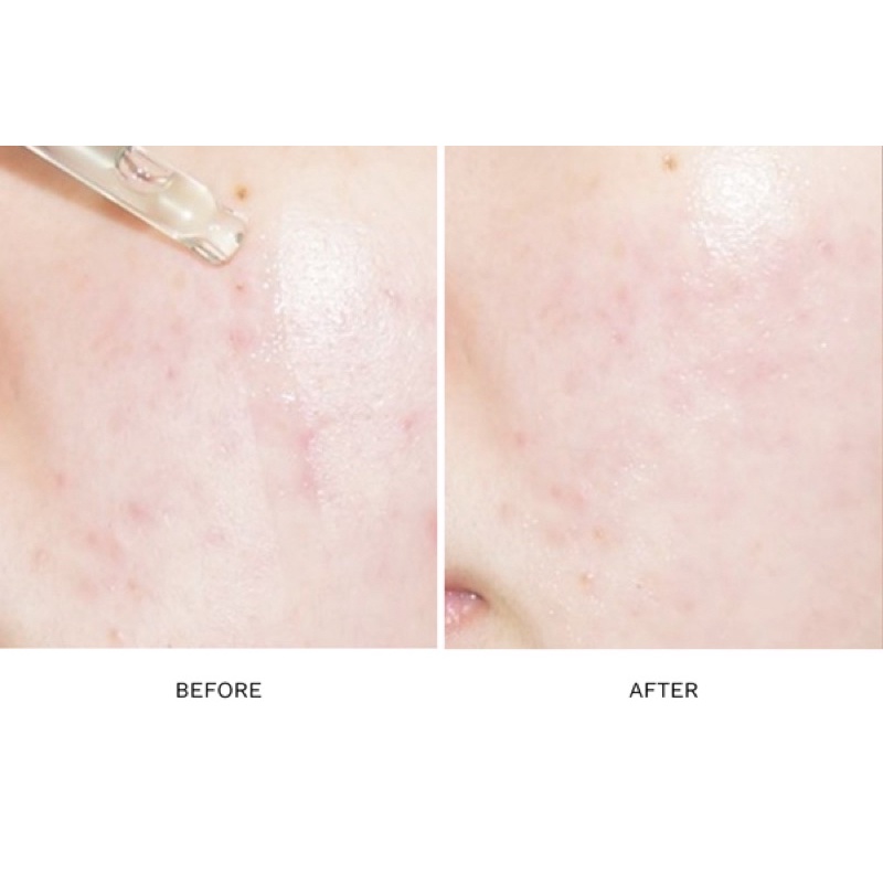 Tinh chất loại bỏ bã nhờn giảm thâm SKINRx LAB MadeCera Cream Fresh Clearing Ampoule 13ml SLMC013AP02