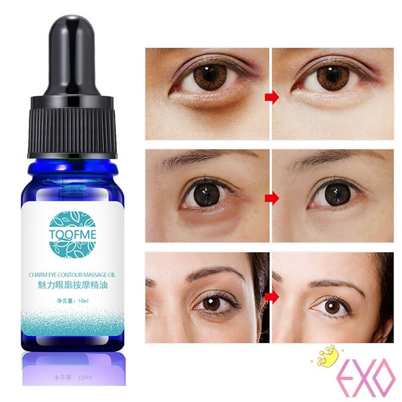 [Hàng mới về] Dầu massage giảm bọng mắt và quầng thâm vùng mắt | BigBuy360 - bigbuy360.vn