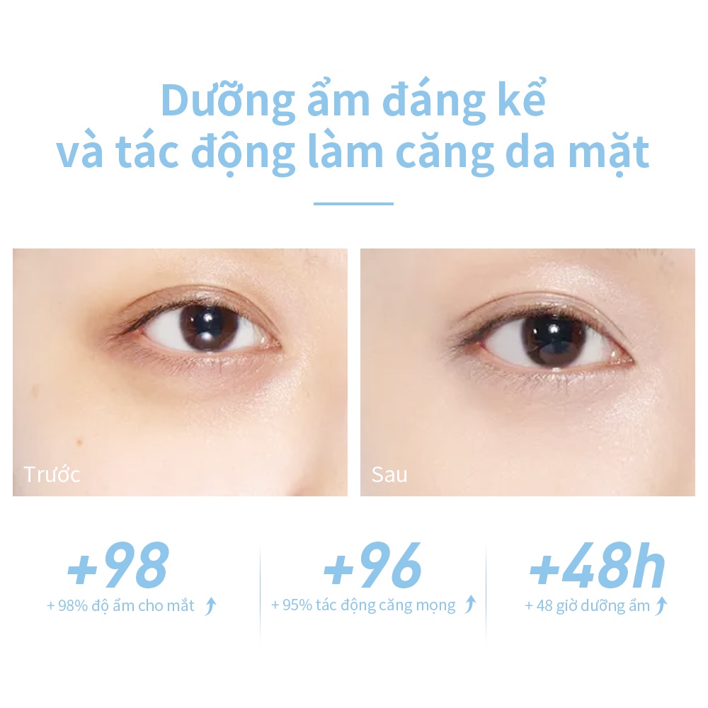 Kem Dưỡng Da Vùng Mắt Lanbena 4D HYALURONIC ACID Dưỡng Ẩm Chống Nếp Nhăn Làm Mịn Quầng Thâm Cho Da Nhạy Cảm 20ml