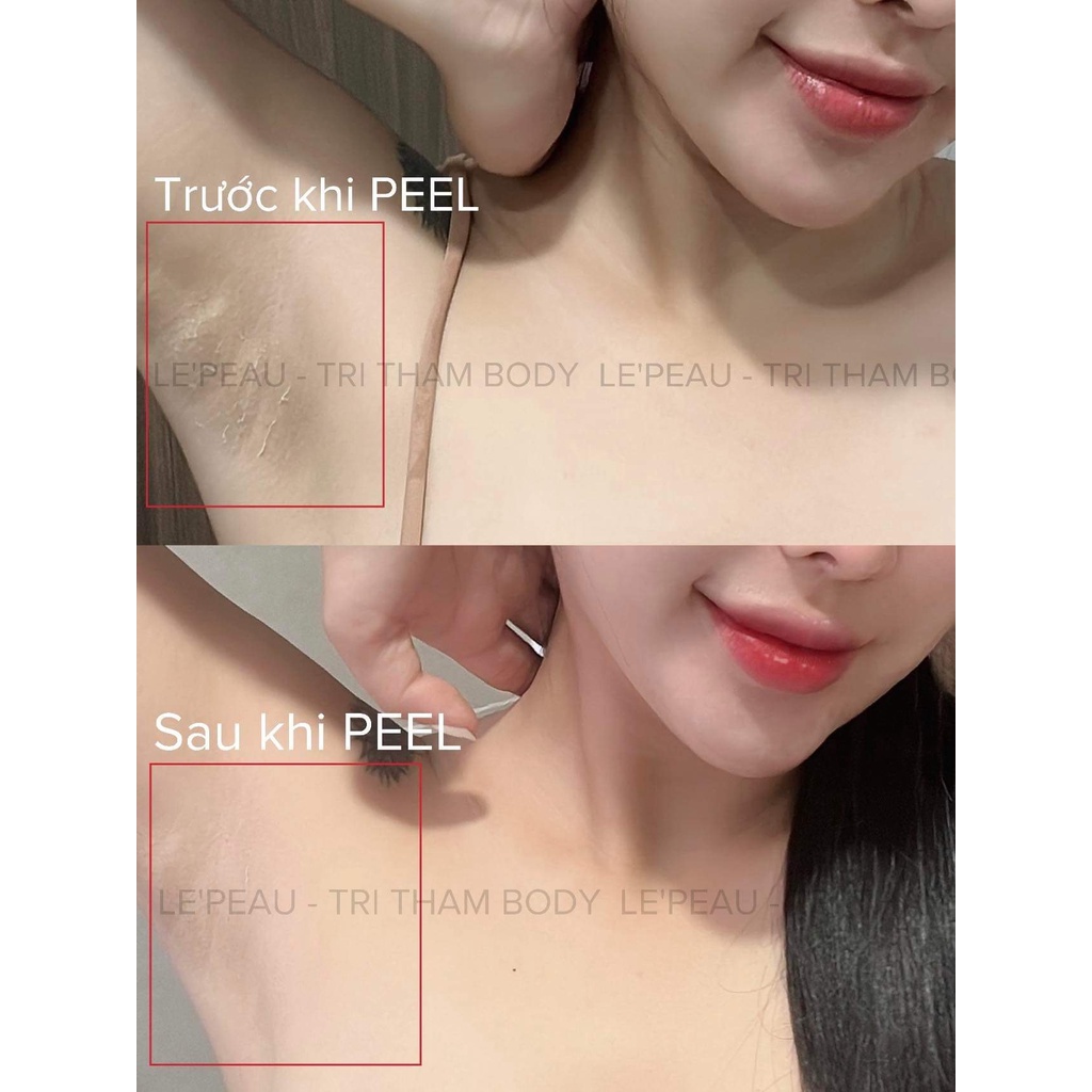 Combo 2 peel body, peel nách, mờ thâm trắng da, dưỡng ẩm da 150ml