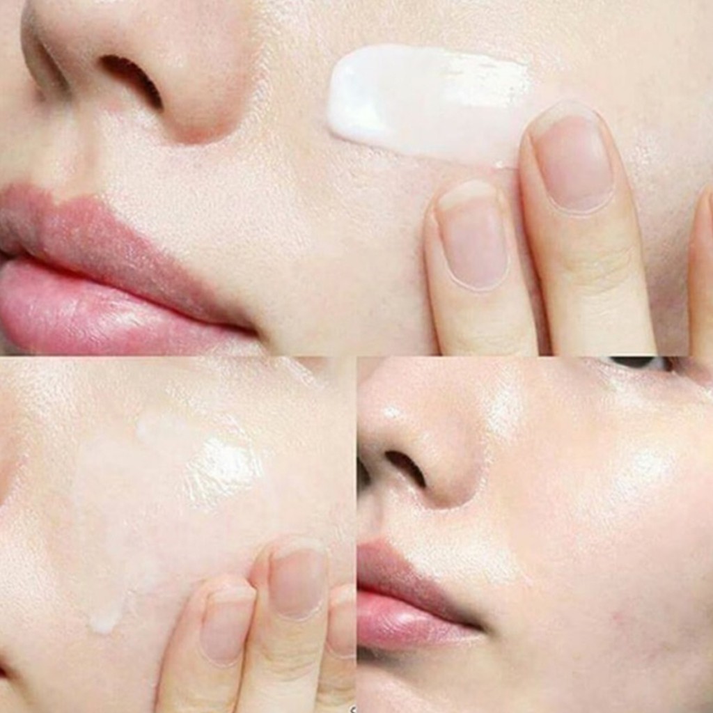 Kem Dưỡng Rau Má Cho Da Mụn Skin1004 Madagascar Centella Cream 75ml