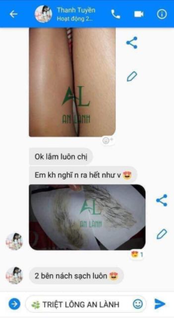 Bộ Triệt lông Vĩnh Viễn Cold Wax và Mỡ Trăn Dược Liệu An Lành (tặng kèm dụng cụ wax) | BigBuy360 - bigbuy360.vn