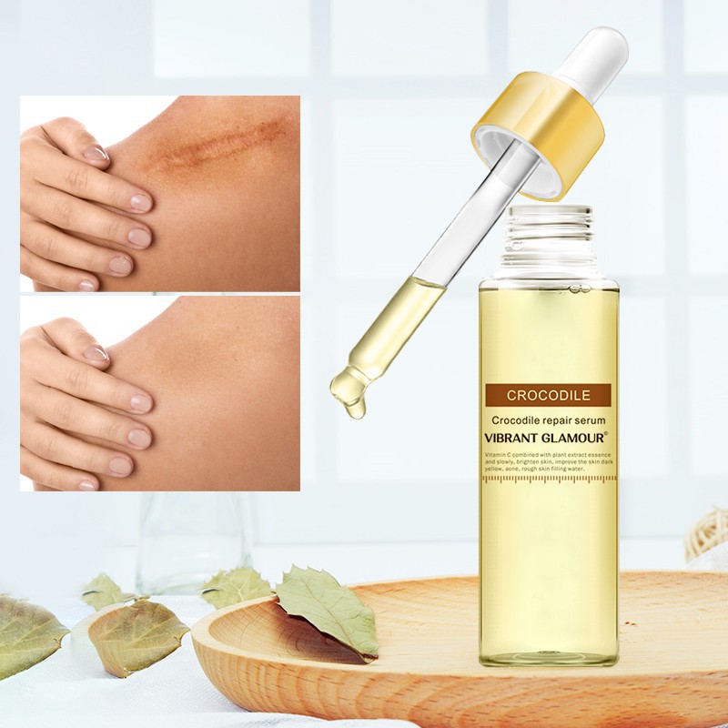 Serum Xóa Sẹo Mụn VIBRANT GLAMOUR Giảm Đốm Loại Bỏ Vết Rạn/Nếp Nhăn Làm Trắng Thu Nhỏ Lỗ Chân Lông 15ml | BigBuy360 - bigbuy360.vn