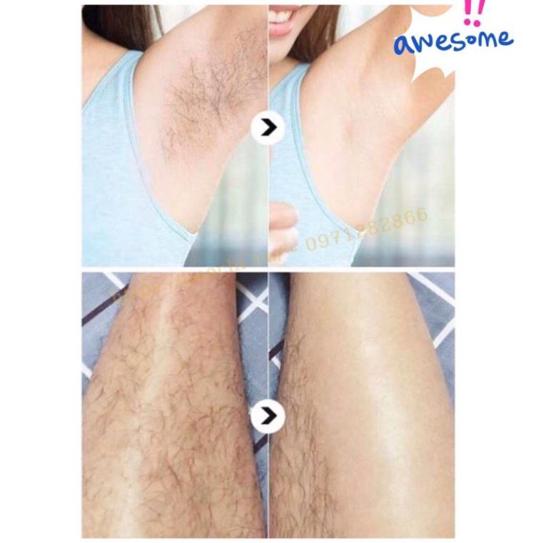 Kem TẨY LÔNG Veet Nhật Bản 150g cho da nhạy cảm . | BigBuy360 - bigbuy360.vn