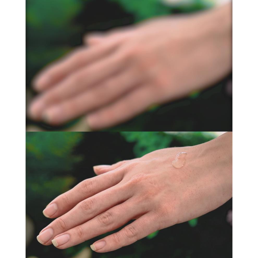 [CHÍNH HÃNG] Tinh Chất Cấp Ẩm Phục Hồi SKINAVIS Hyaluronic Acid & Niacinamide + B5 | BigBuy360 - bigbuy360.vn