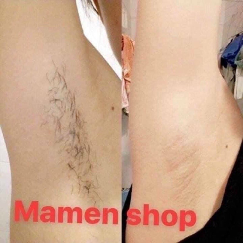 Combo kem tẩy lông&tinh chất cao triệt  MAMENSHOP